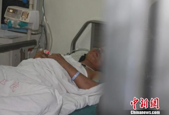 一名被鈍器砸傷的患者在重癥監護室。 肖光明 攝