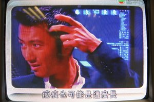 謝霆鋒頭部長瘤診斷為皮膚癌 已經(jīng)切除正康復中